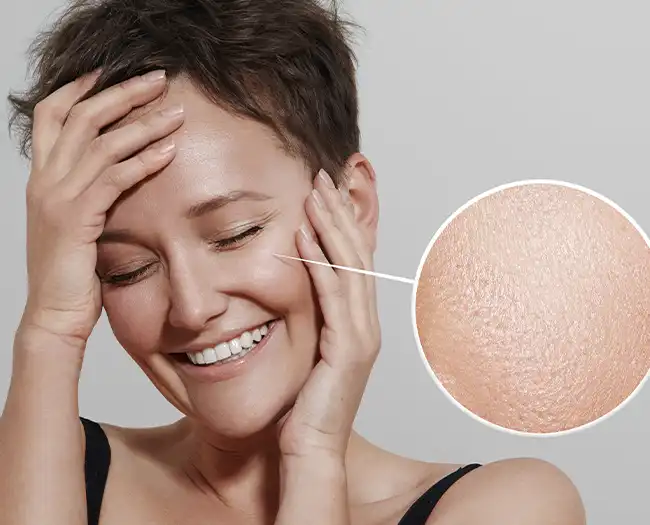 Skin Resurfacing