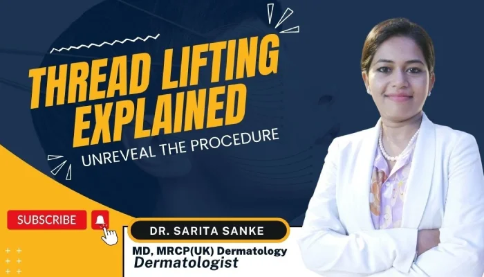 Thread Lifting Explained: Dr. Sarita Unravels the Procedure