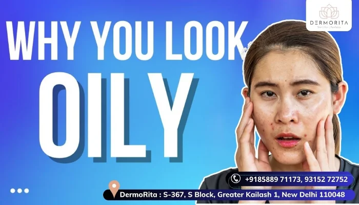 Why you Look Oily by Dr. Sarita Sanke