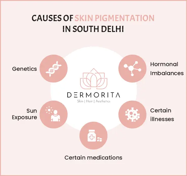 Causes Skin Pigmentation in South Delhi : Genetics, Hormonal imbalances, Sun exposure, Certain medications, Certain illnesses.